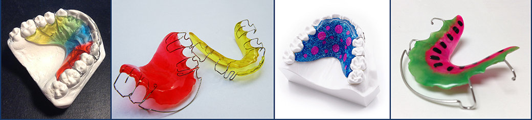 After Braces | Permanent Retainer | Types of Retainers | What is a Retainer | Purpose of Retainer | Hawley Retainer | Essix Retainer | Vivera Retainers | Fixed Retainer | Orthodontics | Orthodontist | Bubbly Moments